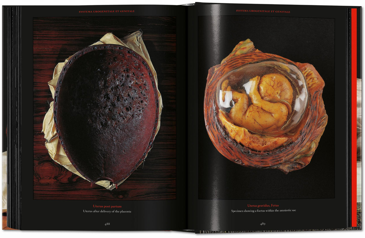 Anatomical Waxes. 45th Ed. (German, French, English)